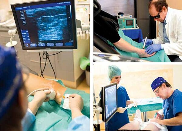 Venenbehandlung mit Ultraschall